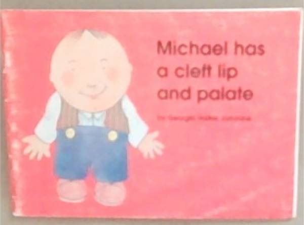 Michael Has A Cleft Lip and Palate